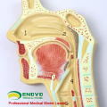 LUNG06 (12503) Human Respiratory Section Abschnitt Modell, Anatomie Modelle&gt; Atmung